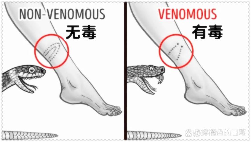 新澳门2025年正版免费和被蛇咬反抓蛇再遭咬与被蛇咬反抓蛇再遭咬伤
